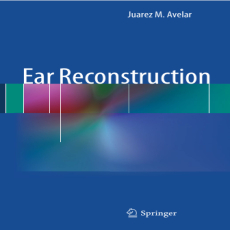 Ear Reconstruction - Juarez Avelar , 1E Ear Reconstruction - Juarez Avelar , 1E